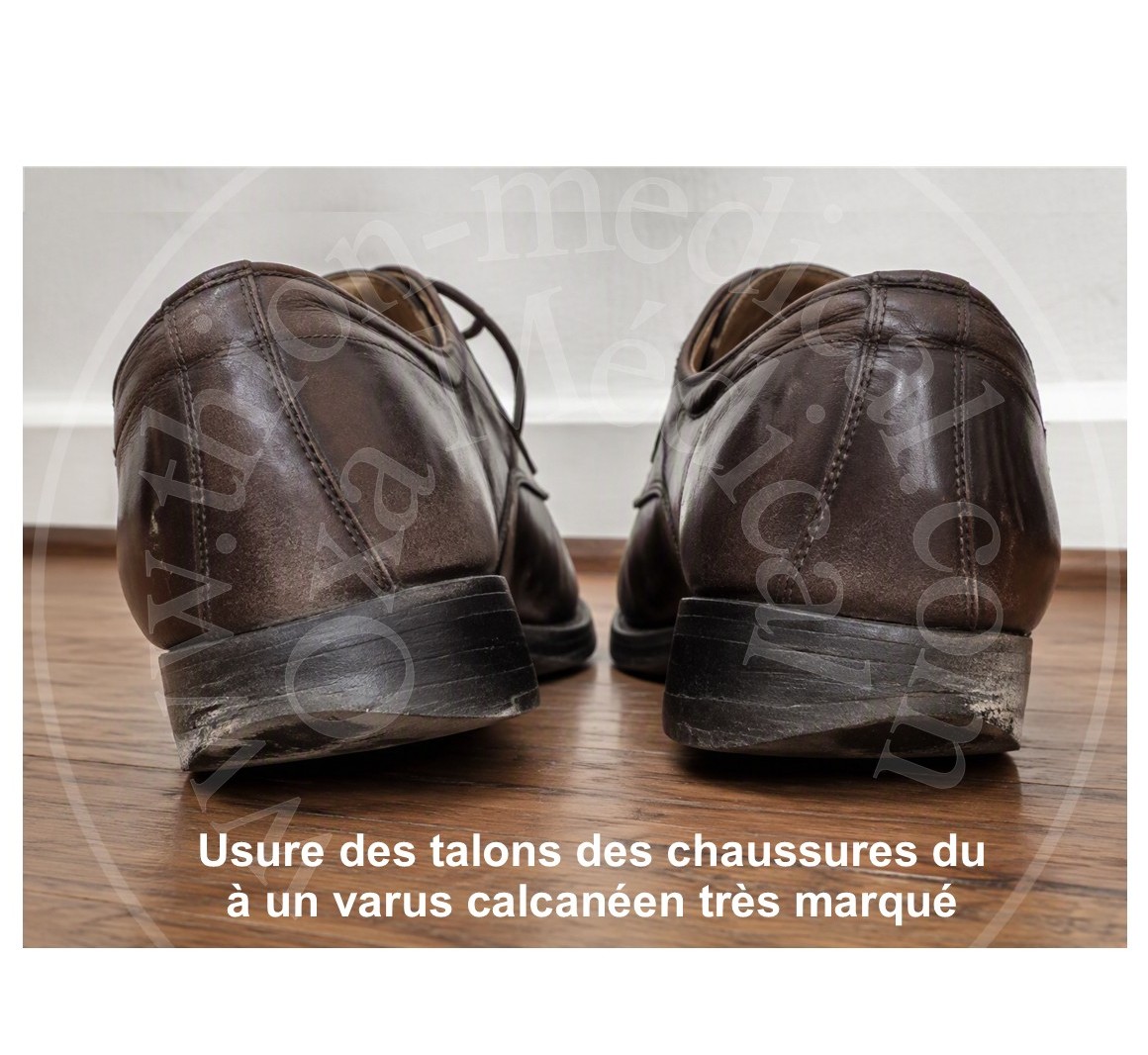 Photo de chaussures de ville usées vers l’extérieur